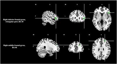 An fMRI Study Using a Combined Task of Interval Discrimination and Oddball Could Reveal Common Brain Circuits of Cognitive Change